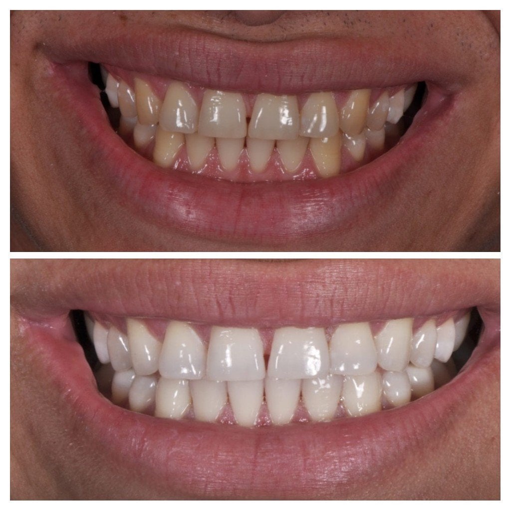Limpeza Profissional